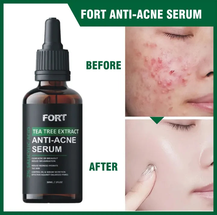 FORT Anti Acne Serum